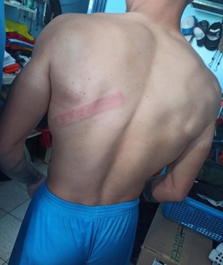 La marque laissée sur Arismendi après l'incident violent. Photo : Alvaro Durán - Escenario deportivo